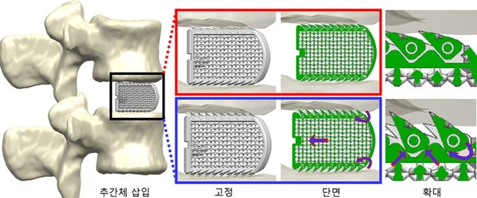 대구경북첨단의료산업진흥재단,2025 MEDITEK 참가 우수기술 선보여
